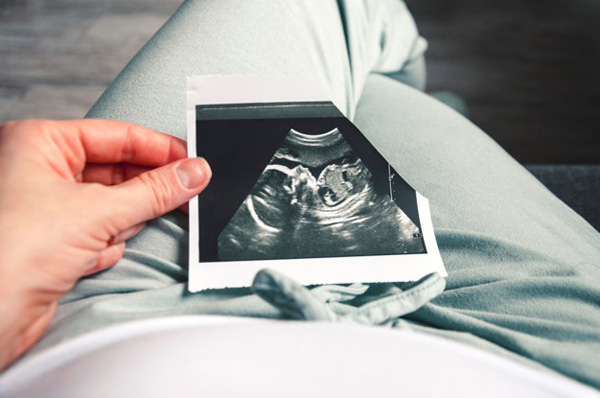 آیا علائم بارداری دوقلو را می‌شناسید؟