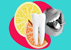علت حساسیت دندان به ترشی چیست و چگونه میتوان آن را درمان کرد؟