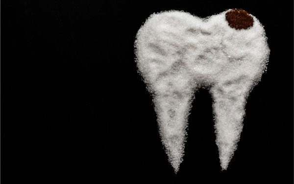 درمان های پزشکی و خانگی حساسیت دندان به شیرینی