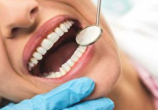 آیا حساسیت دندان به شیرینی را باید جدی بگیریم؟