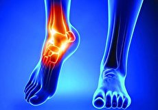 داروی هیالورونات سدیم چیست و در چه مواردی استفاده میشود؟