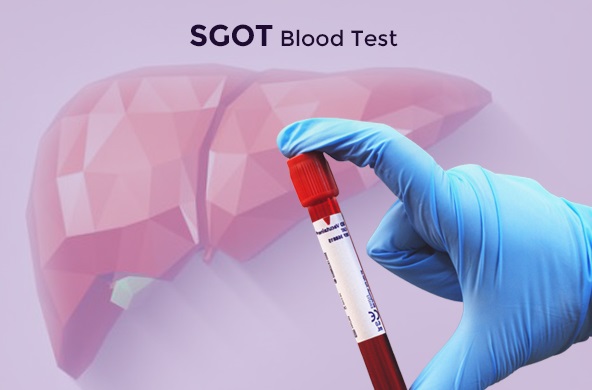 تست SGOT يا AST در آزمايش خون