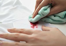 پاک کردن لکه لاک از روی لباس با ترفندهایی ساده