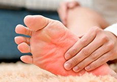 علت سوزش کف پا و درمان آن با راه های پزشکی و خانگی