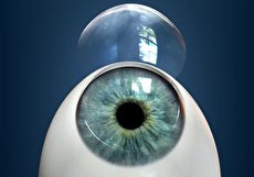 عمل پیوند قرنیه چشم و عوارض آن
