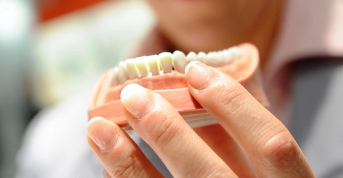 انواع مختلف پروتز دندان؛ پروتزهای ثابت و متحرک