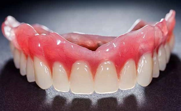 انواع مختلف پروتز دندان؛ دنچر
