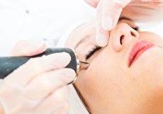 برداشتن خال صورت با لیزر چگونه است و مزایا و معایب آن چیست؟