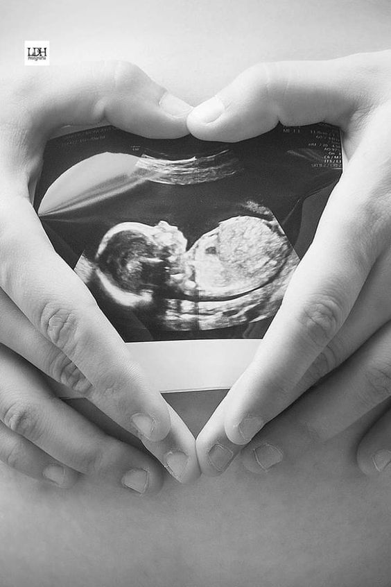 عکس بارداری پسر اینستاگرام