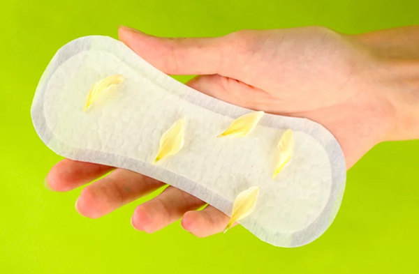 آیا ترشحات پنیری واژن نگران کننده است؟ راه های درمان پزشکی و خانگی