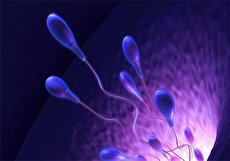 چه رابطه ای بین واریکوسل و ناباروری وجود دارد؟