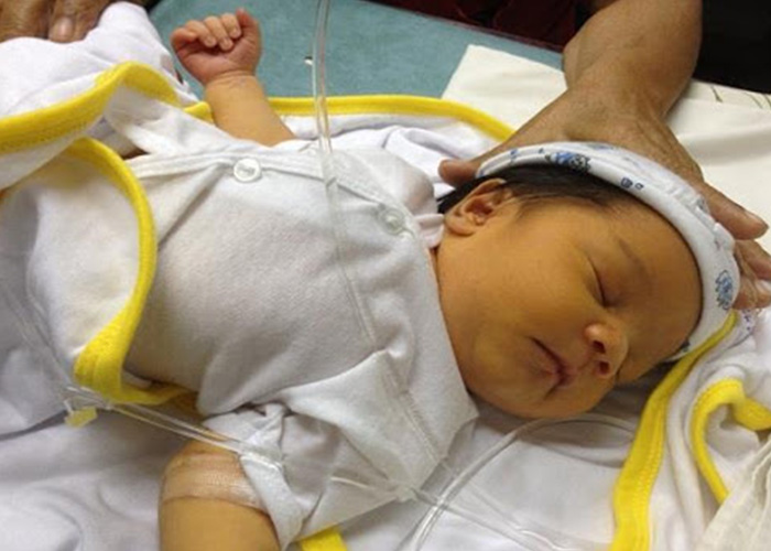علت زردی نوزادان در هنگام تولد چیست + عوامل خطرساز و تشدید کننده زردی نوزادان
