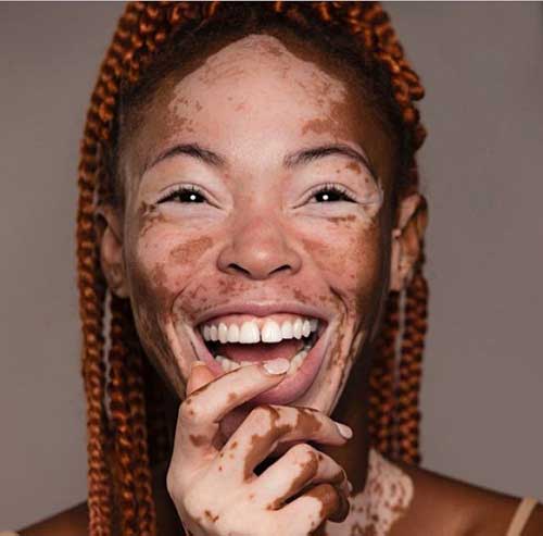 عکس دختر زشت خنده دار