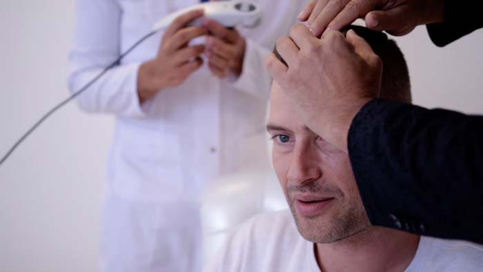 بهترین سن برای انجام عمل کاشت مو چه زمانی است؟