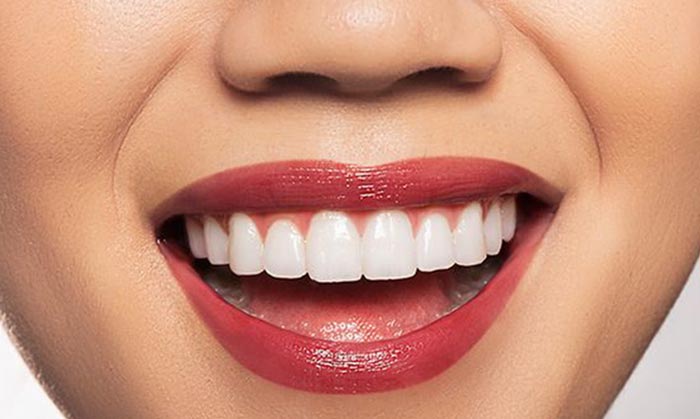 مصاحبه با موسس زیبادنت، اولین کلینیک دندانپزشکی دیجیتال در تهران