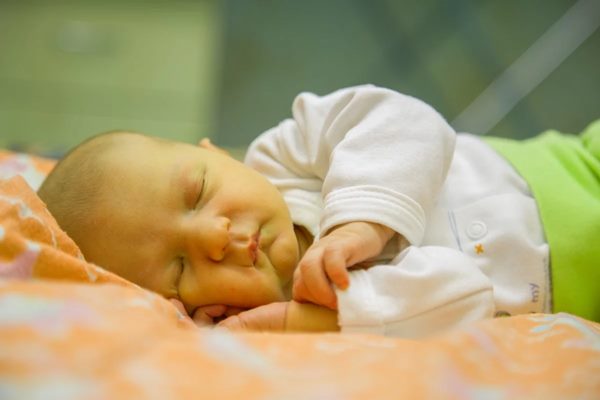 درمان زردی نوزاد در خانه